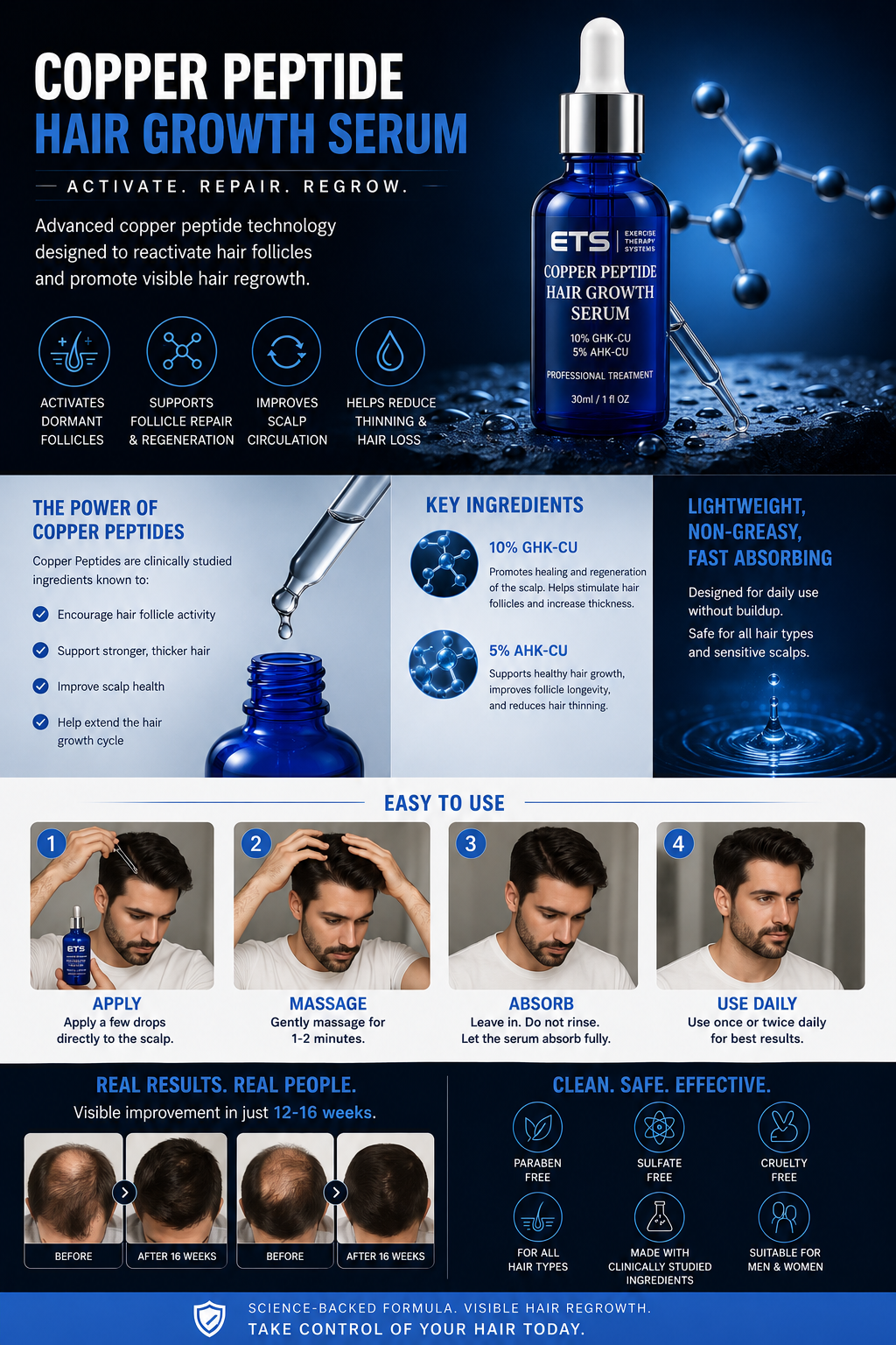 ETS Copper Peptide Hair Growth Serum (10% GHK-Cu + 5% AHK-Cu) – 30ml AND derma roller